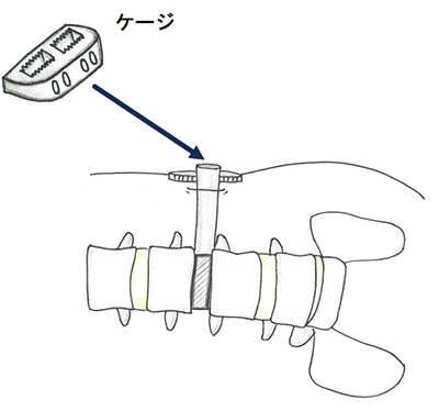 手術の方法