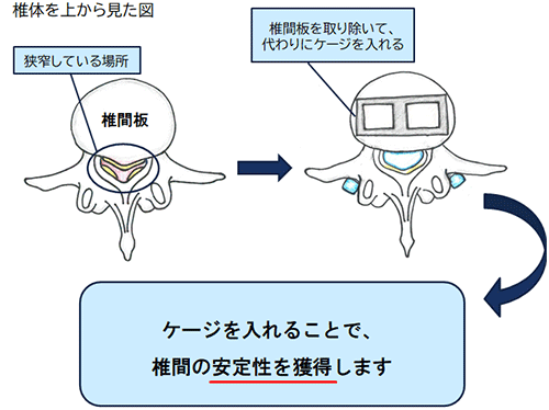 手術の方法