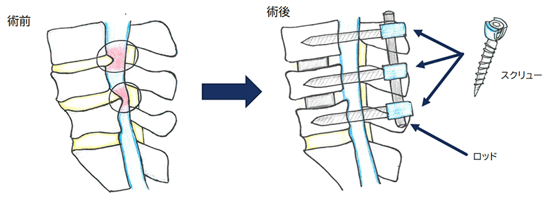 手術の方法